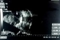 Thumbnail for version as of 09:53, June 1, 2017
