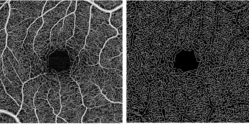 File:Vessel Skeletal Density.png