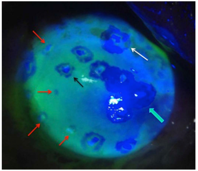 File:SLET fluorescein.png