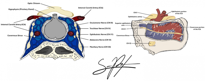 File:Cavernous Sinus Anatomy.png