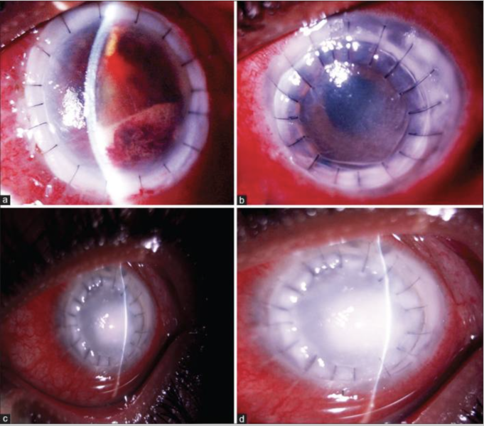 File:Figure 12 .png