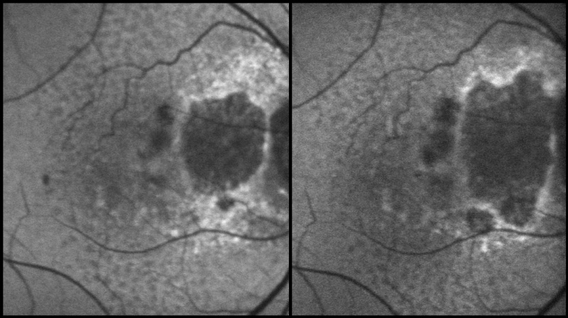 File:GAprogression.jpg