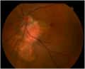 Thumbnail for version as of 19:35, December 1, 2010