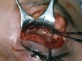 Thumbnail for version as of 19:54, June 1, 2011
