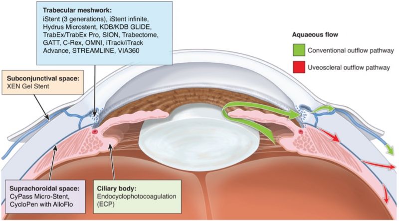 File:Eyewiki MIGS 2025.jpg