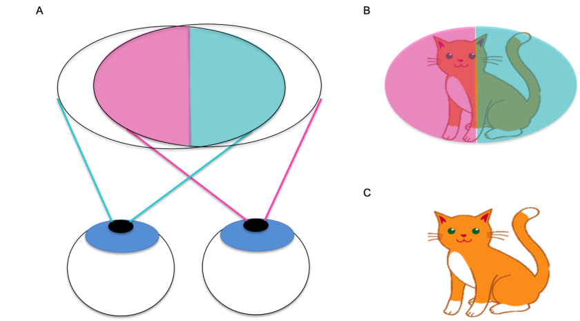 Retinal Hemifield Slide Phenomenon - EyeWiki