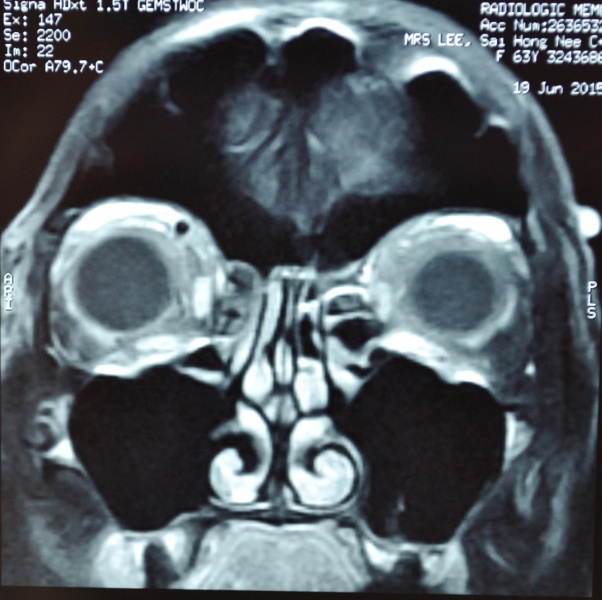 File:MRI.png.jpg