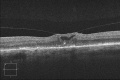 Thumbnail for version as of 15:23, October 26, 2013