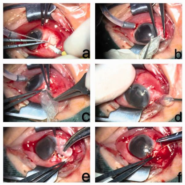 File:FCVB implantation real.jpg