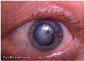 Thumbnail for version as of 16:41, April 18, 2022