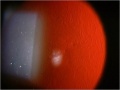 Thumbnail for version as of 09:12, August 3, 2011