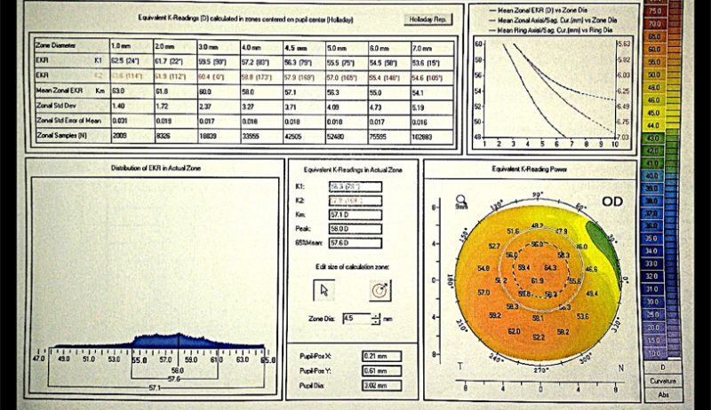 File:Figure3 Tomography.png