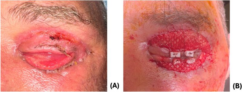 File:Figure 5 Grafting.jpg