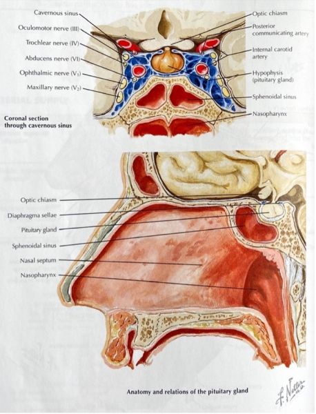File:Sphenoid Sinus.jpg