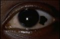 Thumbnail for version as of 09:19, May 5, 2023