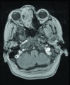 Thumbnail for version as of 19:29, June 7, 2011