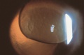 Thumbnail for version as of 15:45, March 10, 2015