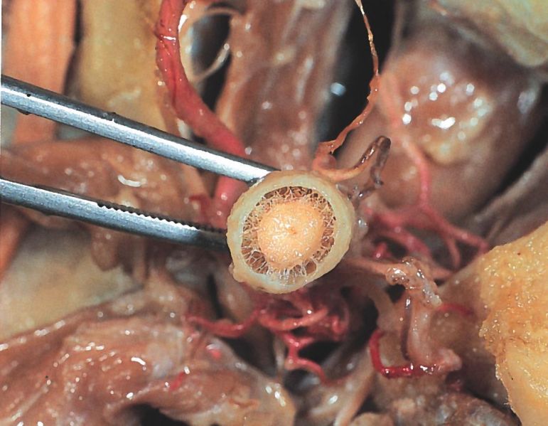 File:AA0 Optic Nerve Anatomy.jpg
