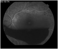 Thumbnail for version as of 10:48, June 14, 2010
