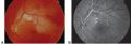 Thumbnail for version as of 22:18, March 9, 2022