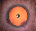 Thumbnail for version as of 20:54, July 10, 2017
