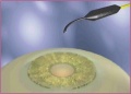 Thumbnail for version as of 11:54, December 3, 2011