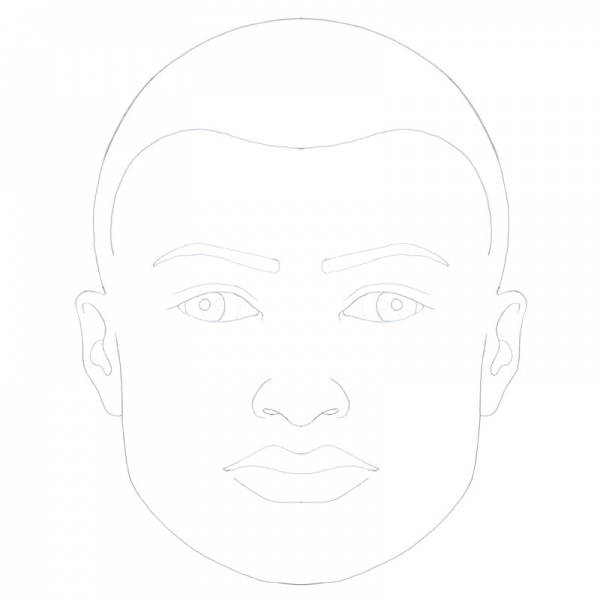 File:Exotropia.jpg