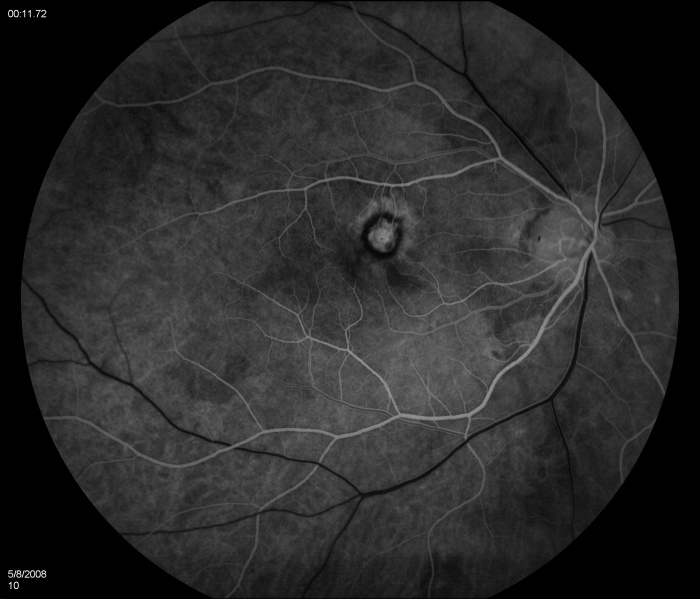 File:Figure 1B.jpg