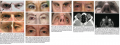 Thumbnail for version as of 11:25, December 1, 2013
