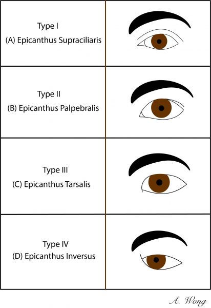 File:Epicanthal Folds.jpg