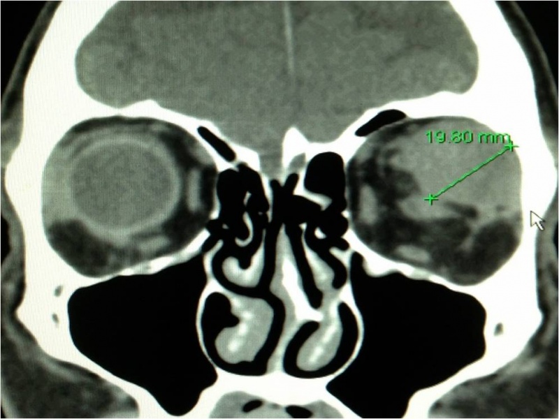 File:CT PALG Figure 3.jpg