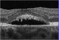 Thumbnail for version as of 21:29, May 23, 2023
