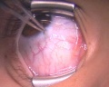 Thumbnail for version as of 12:06, June 28, 2010