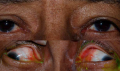 Thumbnail for version as of 15:15, January 26, 2014