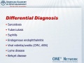 Thumbnail for version as of 10:55, April 10, 2012