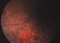 Thumbnail for version as of 00:50, December 1, 2013