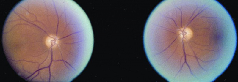 File:AAO PION.jpg