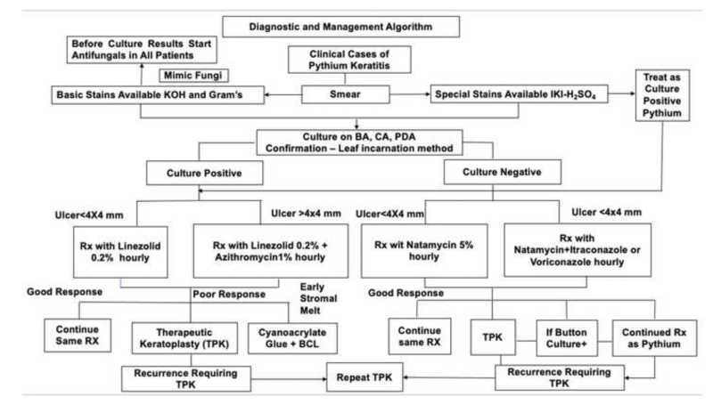 File:Figure 11 Eyewiki.png
