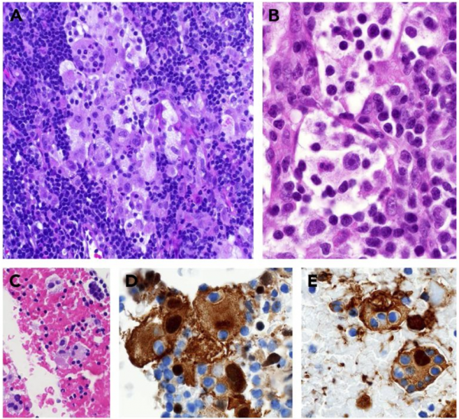 File:RDD Pathology.png