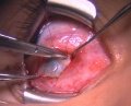 Thumbnail for version as of 12:08, June 28, 2010