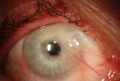 Thumbnail for version as of 20:12, June 3, 2010