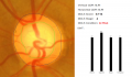 Thumbnail for version as of 07:32, May 31, 2020