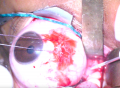 Thumbnail for version as of 18:27, November 22, 2021