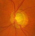 Thumbnail for version as of 21:05, June 20, 2010