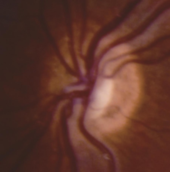 File:ONH 2.jpg
