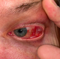 Thumbnail for version as of 13:46, February 6, 2021