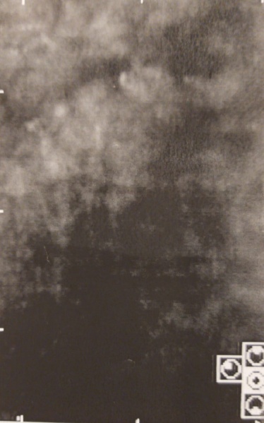 File:Specular microscopy.jpg