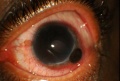 Thumbnail for version as of 09:35, January 14, 2011