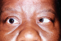 Thumbnail for version as of 16:20, May 11, 2023