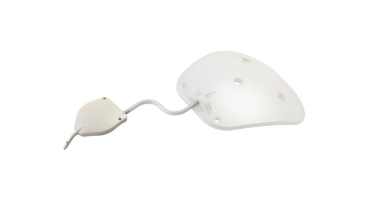 EyeWatch Implant - EyeWiki